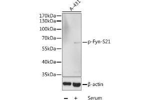 Western blot analysis of extracts of A-431 cells, using Phospho-Fyn-S21 antibody (ABIN6135226, ABIN6136086, ABIN6136087 and ABIN6225545) at 1:1000 dilution. (FYN anticorps  (pSer21))