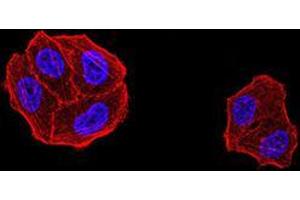 Immunofluorescence analysis of Hela cells using DDX1 mouse mAb. (DDX1 anticorps  (AA 642-740))