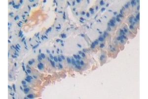 Detection of MUC1 in Mouse Lung Tissue using Polyclonal Antibody to Mucin 1 (MUC1)