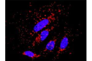 Proximity Ligation Analysis of protein-protein interactions between PRKCZ and AKT3.