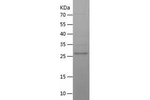 Western Blotting (WB) image for Renalase, FAD-Dependent Amine Oxidase (RNLS) (AA 23-285) protein (His tag) (ABIN7124823)