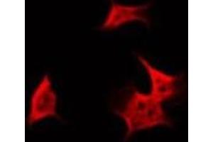 ABIN6266842 staining HuvEc by IF/ICC. (FARP2 anticorps  (Internal Region))