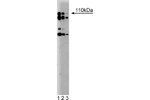 Western Blotting (WB) image for anti-Phosphoinositide-3-Kinase, Catalytic, delta Polypeptide (PIK3CD) (AA 73-90) antibody (ABIN968316)
