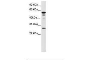 Image no. 1 for anti-Forkhead Box D1 (FOXD1) (AA 24-73) antibody (ABIN6736081) (FOXD1 anticorps  (AA 24-73))