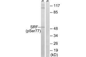 Western blot analysis of extracts from Jurkat cells, treated with PMA (125 ng/mL, 30 mins), using SRF (Phospho-Ser77) antibody.