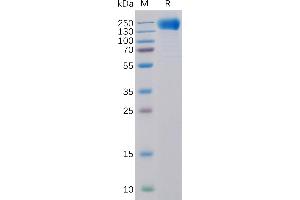 Human EGFR Protein, His Tag on SDS-PAGE under reducing condition.