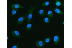 IF analysis of FABP5 using anti-FABP5 antibody (ABIN5692847).