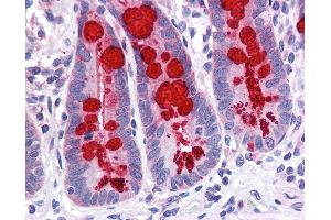 Anti-SLC9A3R1 / NHERF1 antibody IHC of human small intestine. (SLC9A3R1 anticorps  (AA 252-359))