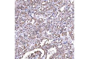 IHC analysis of SCML1 using anti-SCML1 antibody (ABIN7602479). (SCML1 anticorps  (AA 8-322))