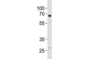 Western blot analysis of lysate from mouse kidney tissue using ALK3 antibody diluted at 1:1000. (BMPR1A anticorps  (AA 30-60))
