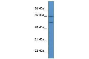COL8A2 antibody used at 0. (COL8a2 anticorps  (C-Term))