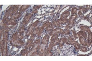 Detection of CASP3 in Rat Kidney Tissue using Polyclonal Antibody to Caspase 3 (CASP3)