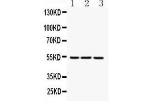 Western blot analysis of FGG expression in rat liver extract ( Lane 1), mouse liver extract ( Lane 2) and HEPG2 whole cell lysates ( Lane 3). (FGG anticorps  (N-Term))