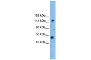 Image no. 1 for anti-DEAH (Asp-Glu-Ala-His) Box Polypeptide 8 (DHX8) (AA 71-120) antibody (ABIN6744511) (DHX8 anticorps  (AA 71-120))