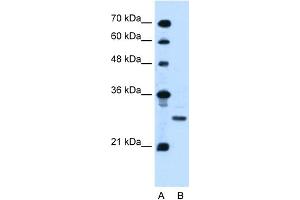 WB Suggested Anti-PDPN Antibody Titration:  0. (Podoplanin anticorps  (N-Term))