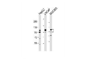 Western Blot at 1:2000 dilution Lane 1: HepG2 whole cell lysate Lane 2: LNCaP whole cell lysate Lane 3: MGC803 whole cell lysate Lysates/proteins at 20 ug per lane. (Anoctamin 7 anticorps  (N-Term))