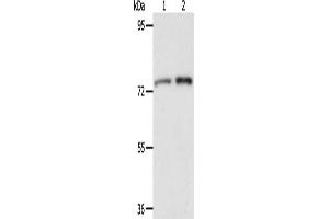 Gel: 8 % SDS-PAGE, Lysate: 40 μg, Lane 1-2: Mouse liver tissue, Mouse kidney tissue, Primary antibody: ABIN7128172(ACOX2 Antibody) at dilution 1/350, Secondary antibody: Goat anti rabbit IgG at 1/8000 dilution, Exposure time: 2 minutes (Acox2 anticorps)
