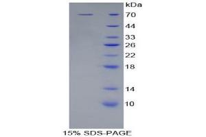 SDS-PAGE (SDS) image for Killer Cell Immunoglobulin-Like Receptor, Two Domains, Long Cytoplasmic Tail, 2 (KIR2DL2) (AA 22-339) protein (His tag,GST tag) (ABIN2123114) (KIR2DL2 Protein (AA 22-339) (His tag,GST tag))