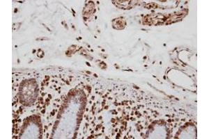 anti-Transcription Elongation Regulator 1 (TCERG1) (AA 419-1077) antibody