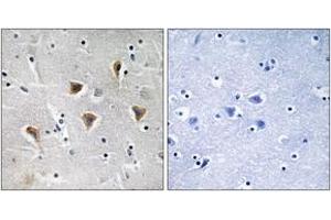 Immunohistochemistry analysis of paraffin-embedded human brain tissue, using MTERF Antibody.