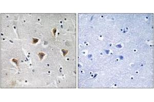 Immunohistochemistry analysis of paraffin-embedded human brain tissue, using MTERF Antibody. (MTERF anticorps  (AA 267-316))