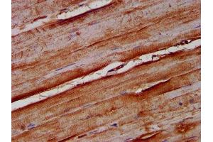 IHC image of ABIN7161669 diluted at 1:100 and staining in paraffin-embedded human skeletal muscle tissue performed on a Leica BondTM system.