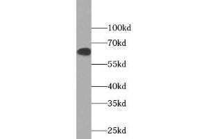 Western blot analysis of Jurkat cells subjected to SDS-PAGE, using NOX5 antibody (1:1000 dilution). (NOX5 anticorps)