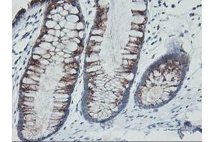 Immunohistochemical staining of paraffin-embedded Human colon tissue using anti-GOLM1 mouse monoclonal antibody. (GOLM1 anticorps)