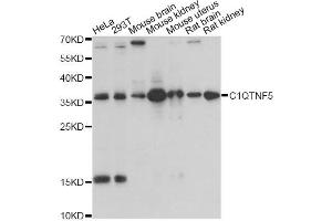 Western blot analysis of extracts of various cell lines, using C1QTNF5 antibody (ABIN1871381) at 1:1000 dilution. (CTRP5 anticorps)