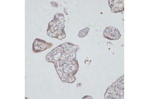 Immunohistochemistry of paraffin-embedded human placenta using TFRC antibody.