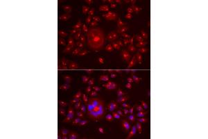 Immunofluorescence analysis of A549 cells using GORASP1 antibody.