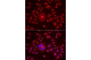 Immunofluorescence analysis of A549 cells using GORASP1 antibody.
