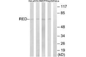 Western Blotting (WB) image for anti-Protein Red (IK) (AA 508-557) antibody (ABIN2890548)