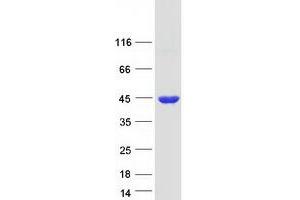 Validation with Western Blot