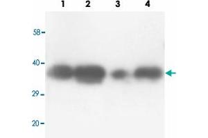 Western blot analysis of tissue lysates with TNFAIP1 polyclonal antibody . (TNFAIP1 anticorps  (N-Term))