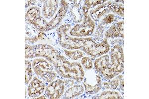 Immunohistochemistry of paraffin-embedded mouse kidney using THBS1 Rabbit pAb (ABIN3022978, ABIN3022979, ABIN3022980 and ABIN6219329) at dilution of 1:50 (40x lens).
