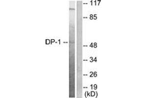 Western Blotting (WB) image for anti-Transcription Factor Dp-1 (TFDP1) (AA 361-410) antibody (ABIN2889186) (DP1 anticorps  (AA 361-410))