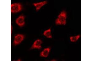 ABIN6278607 staining Hela by IF/ICC. (OR2T5/2T29 anticorps)
