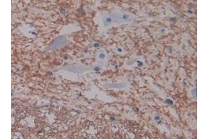 Detection of ICAM1 in Rat Spinal cord Tissue using Polyclonal Antibody to Intercellular Adhesion Molecule 1 (ICAM1)