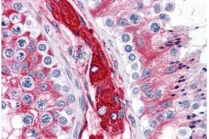 Human Testis: Formalin-Fixed, Paraffin-Embedded (FFPE) (WDR35 anticorps  (N-Term))