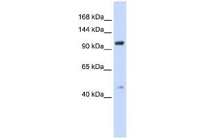 WB Suggested Anti-TRPC4 Antibody Titration:  0. (TRPC4 anticorps  (Middle Region))
