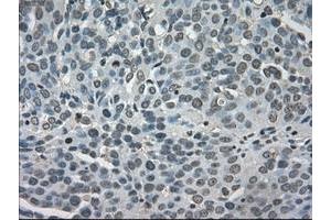 Image no. 2 for anti-Lactate Dehydrogenase A (LDHA) antibody (ABIN1499114)