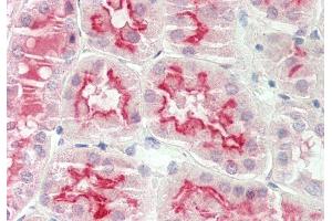 Rabbit Anti-ARSE antibody  Formalin Fixed Paraffin Embedded Tissue: Human Kidney Primary antibody Concentration: 1:100 Secondary Antibody: Donkey anti-Rabbit-Cy3 Secondary Antibody Concentration: 1:200 Magnification: 20x Exposure Time: 0. (Arylsulfatase E anticorps  (Middle Region))