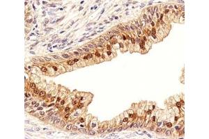 IHC analysis of FFPE human prostate section using IDH1 antibody (IDH1 anticorps  (AA 116-143))