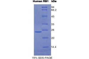 SDS-PAGE analysis of Human RB1 Protein.