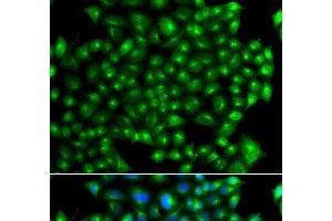 Immunofluorescence analysis of A549 cells using ZFYVE1 Polyclonal Antibody (ZFYVE1 anticorps)