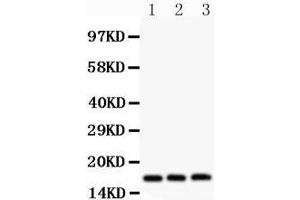 Western Blotting (WB) image for anti-Fragile Histidine Triad (FHIT) (AA 1-147) antibody (ABIN3042392)