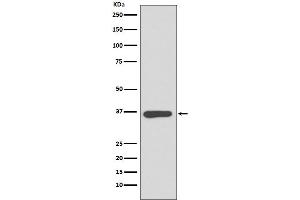 Western blot analysis of Annexin A10 expression in HeLa cell lysate.