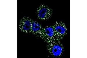 Immunofluorescence (IF) image for anti-serpin Peptidase Inhibitor, Clade B (Ovalbumin), Member 5 (SERPINB5) antibody (ABIN2996527) (SERPINB5 anticorps)