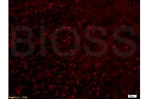 Formalin-fixed and paraffin-embedded rat colitis labeled with Anti-APOA2 Polyclonal Antibody, Unconjugated (ABIN708686) 1:200, overnight at 4°C, The secondary antibody was Goat Anti-Rabbit IgG, Cy3 conjugated used at 1:200 dilution for 40 minutes at 37°C.